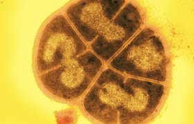 Colonized extremophile Deinococcus radiodurans alleviates toxicity