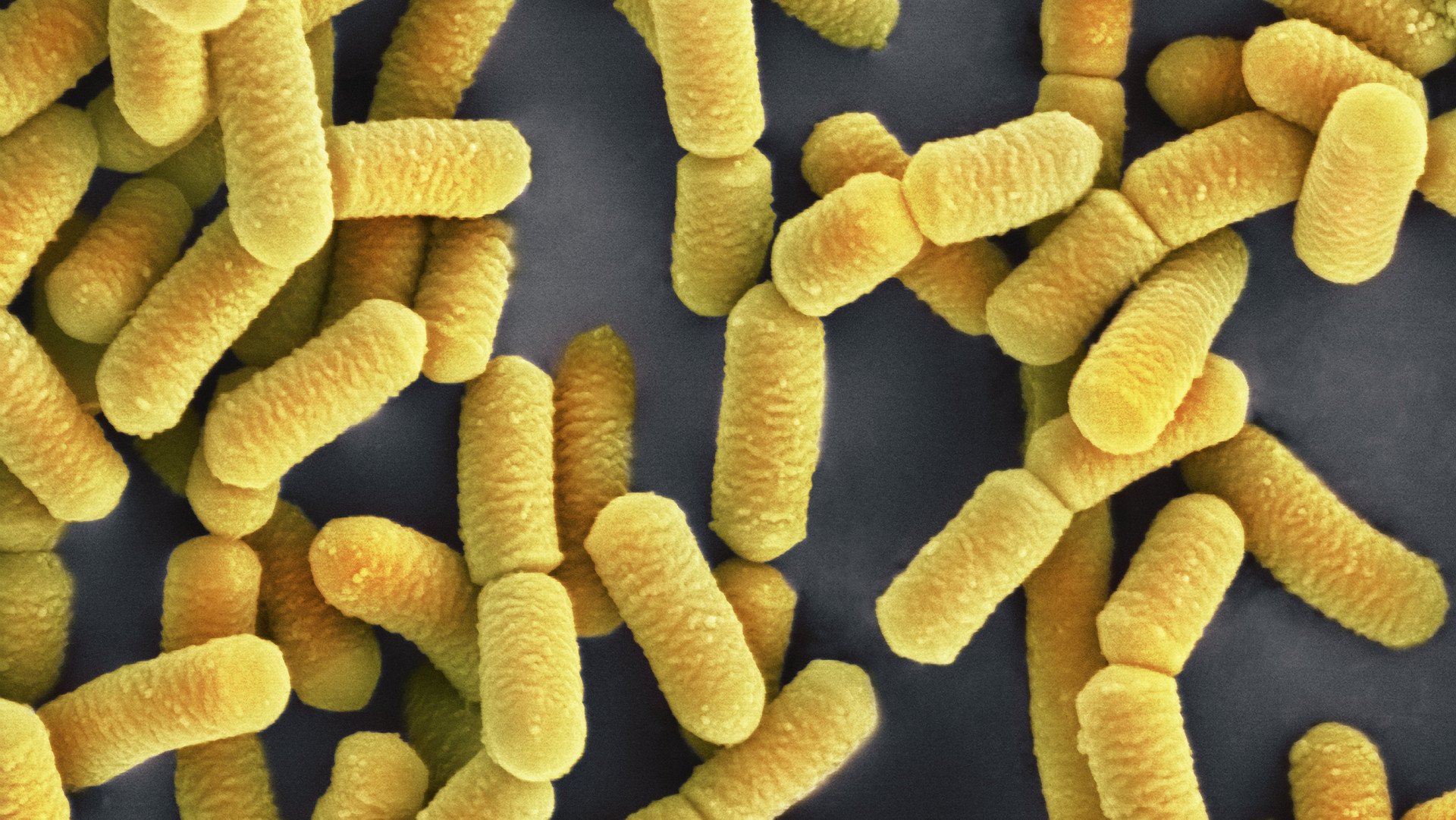 Желтые бактерии. Болгарская палочка лактобактерии. Молочнокислые бактерии Lactobacillus. Lactobacillus rhamnosus hn001. Лактобациллус плантарум.