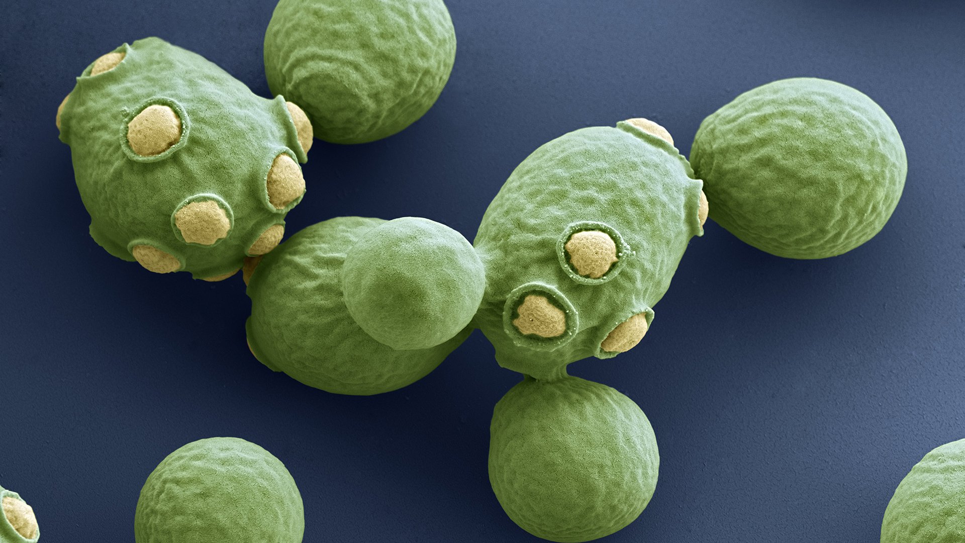 Saccharomyces cerevisiae_ANP_gist_bier_bakkers_groen_geel_uitstulpsels_1920x1080.jpg