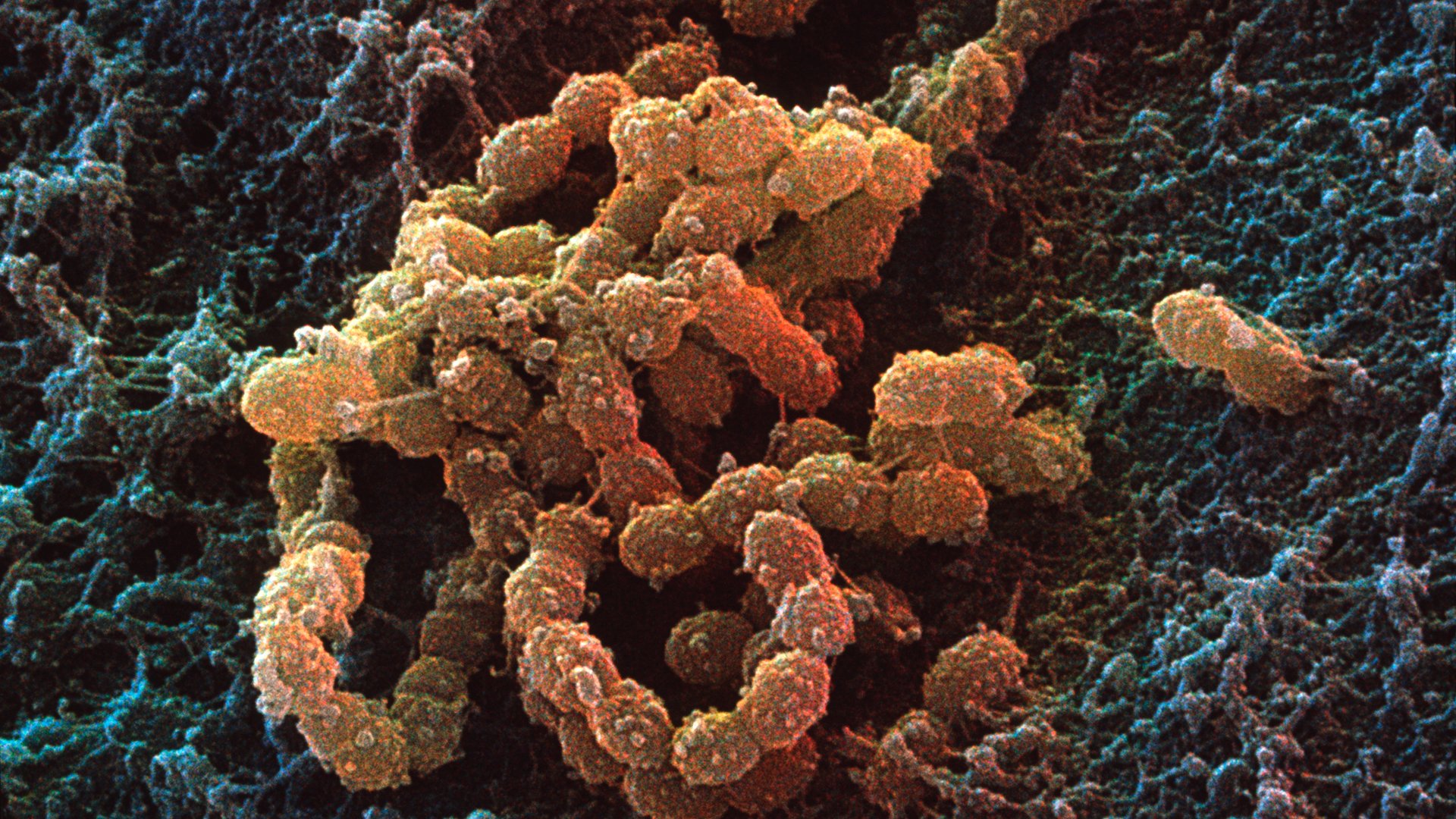strep throat bacteria microscope
